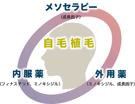 自毛植毛 メゾセラピー(成長因子),内服薬(フィナステリド,ミノキシジル),外用薬(ミノキシジル,成長因子)