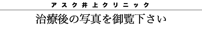 治療後の写真をご覧下さい