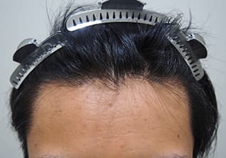 治療後の写真