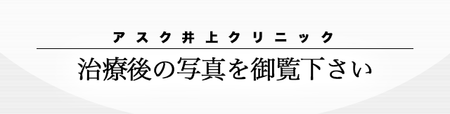 治療後の写真を御覧下さい