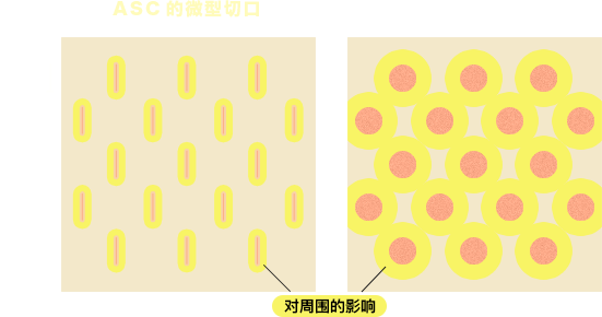 ASCのマイクロスリットと一般のマイクロホールのちがい