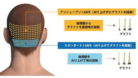 アスクの技術が光るハイブリッドi-SAFE
