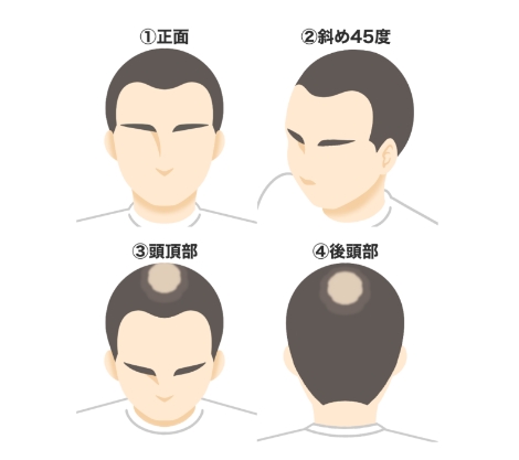 写真の送付
