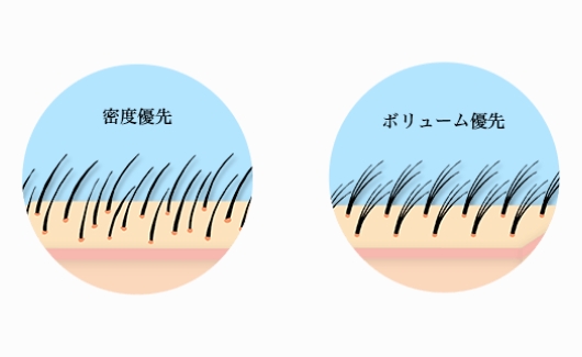 小さな株を密集させる密度優先の植毛法と比較的大きい株を使うボリューム優先の植毛法を使い分ける