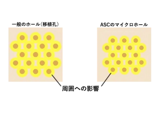 世界最小限のマイクロパンチで高密度な植毛を実現