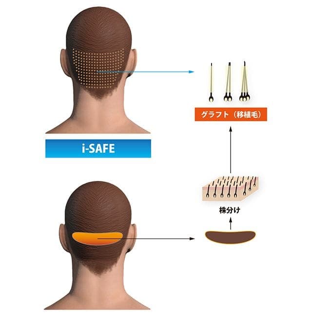 i-safe 6つのアドバンテージ画像