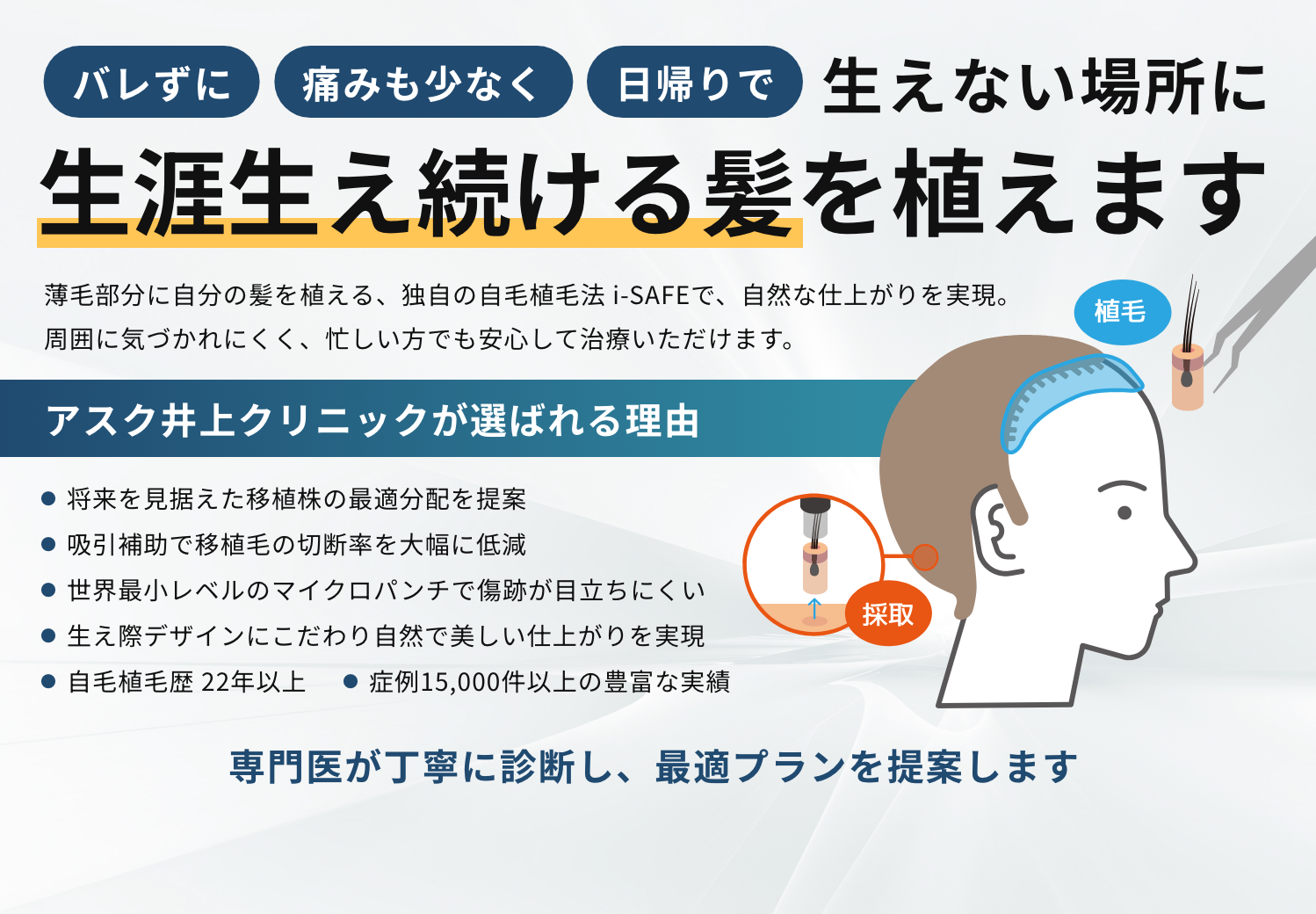 生えない場所に 生涯生え続ける髪を植えます 薄毛部分に自分の髪を植える、独自の自毛植毛法 i-SAFEで、自然な仕上がりを実現。周囲に気づかれにくく、忙しい方でも安心して治療いただけます。 アスク井上クリニックが選ばれる理由 将来を見据えた移植株の最適分配を提案 吸引補助で移植毛の切断率を大幅に低減 世界最小レベルのマイクロパンチで傷跡が目立ちにくい 生え際デザインにこだわり自然で美しい仕上がりを実現 自毛植毛歴 22年以上 症例15,000件以上の豊富な実績