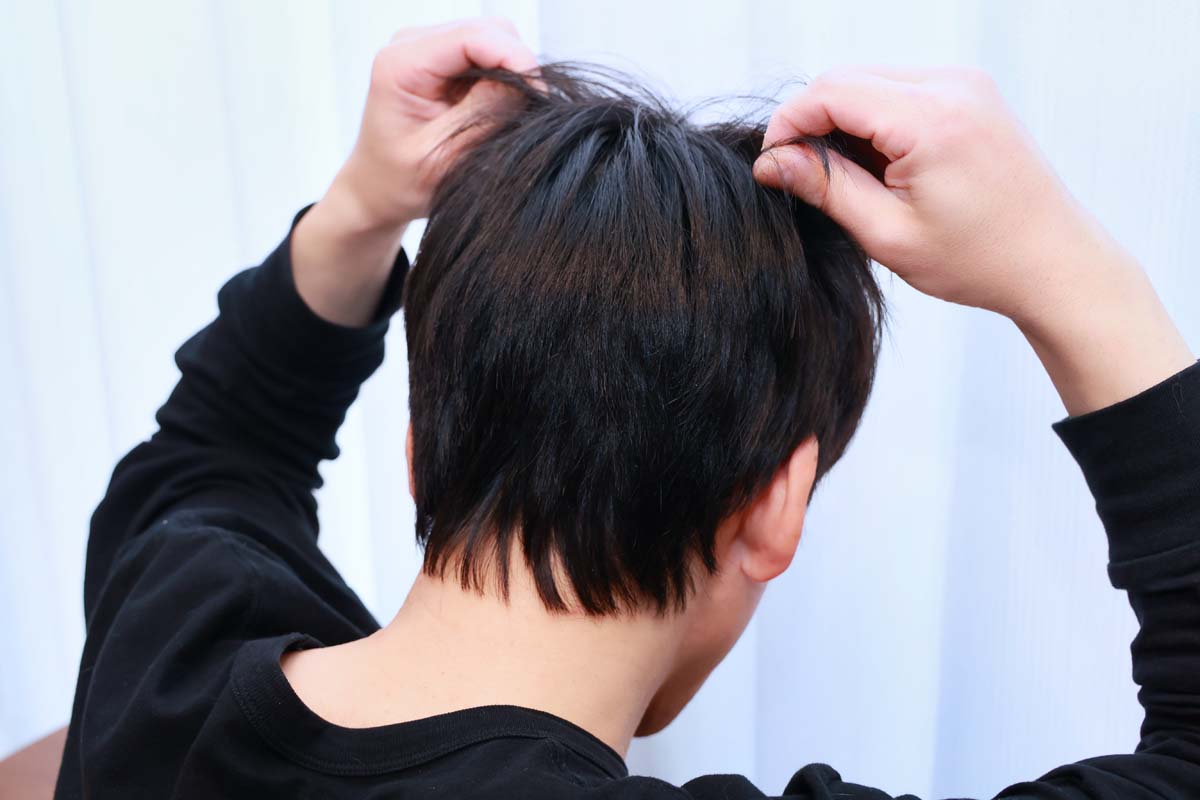 薄毛の原因の誤解