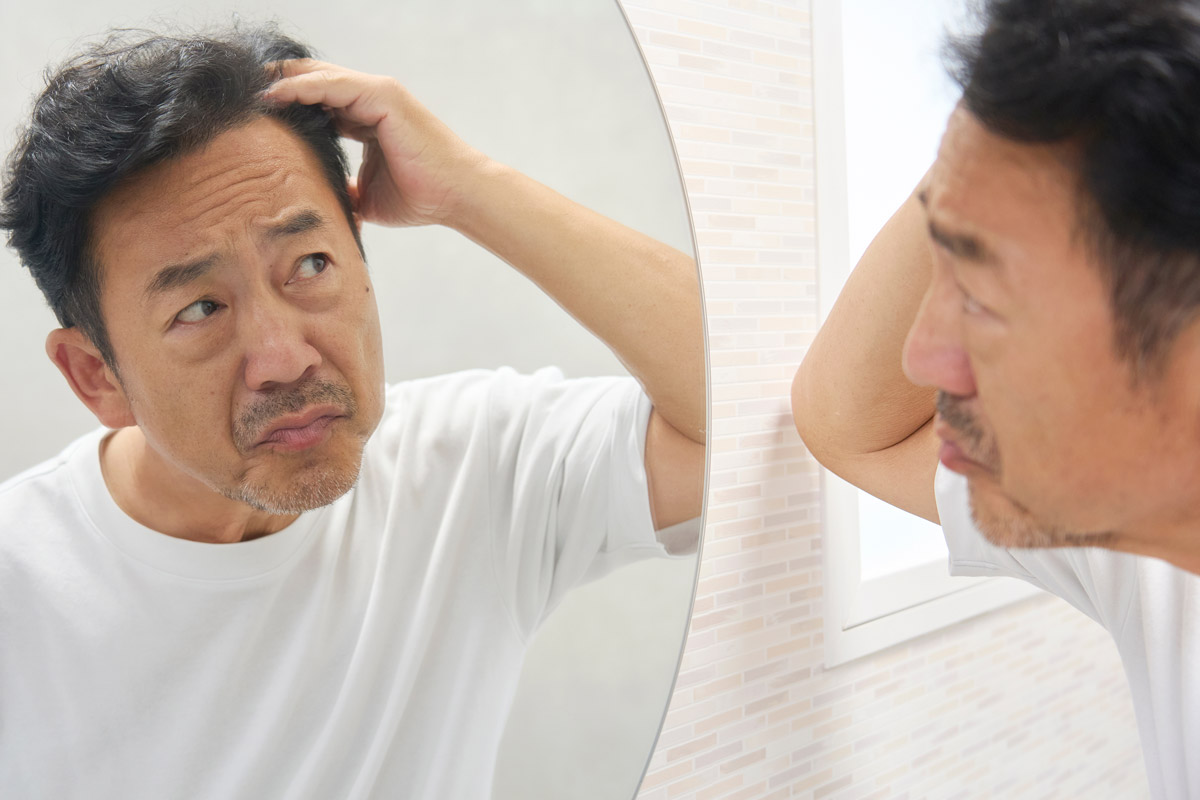 自毛植毛の10年後は？効果持続性や後悔しないためのポイントも解説