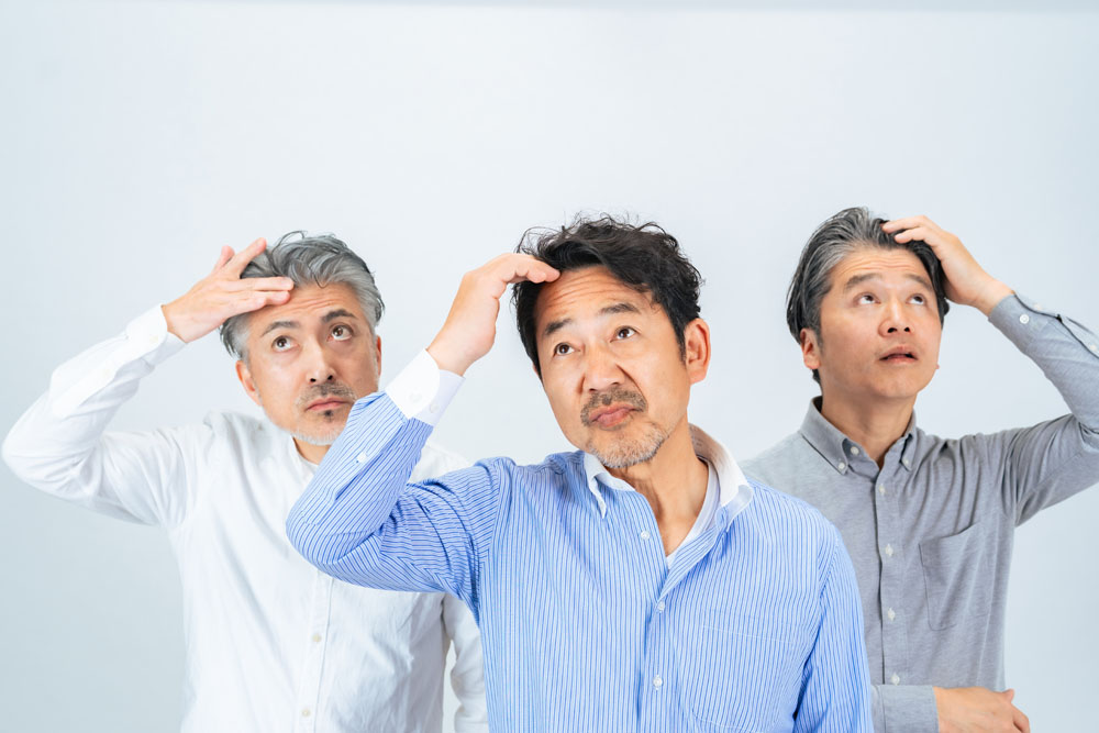 AGAで完治した人はいる？薬治療と自毛植毛の違いを解説