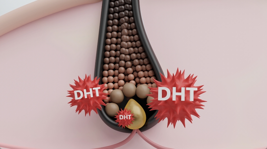 ジヒドロテストステロン 増える原因