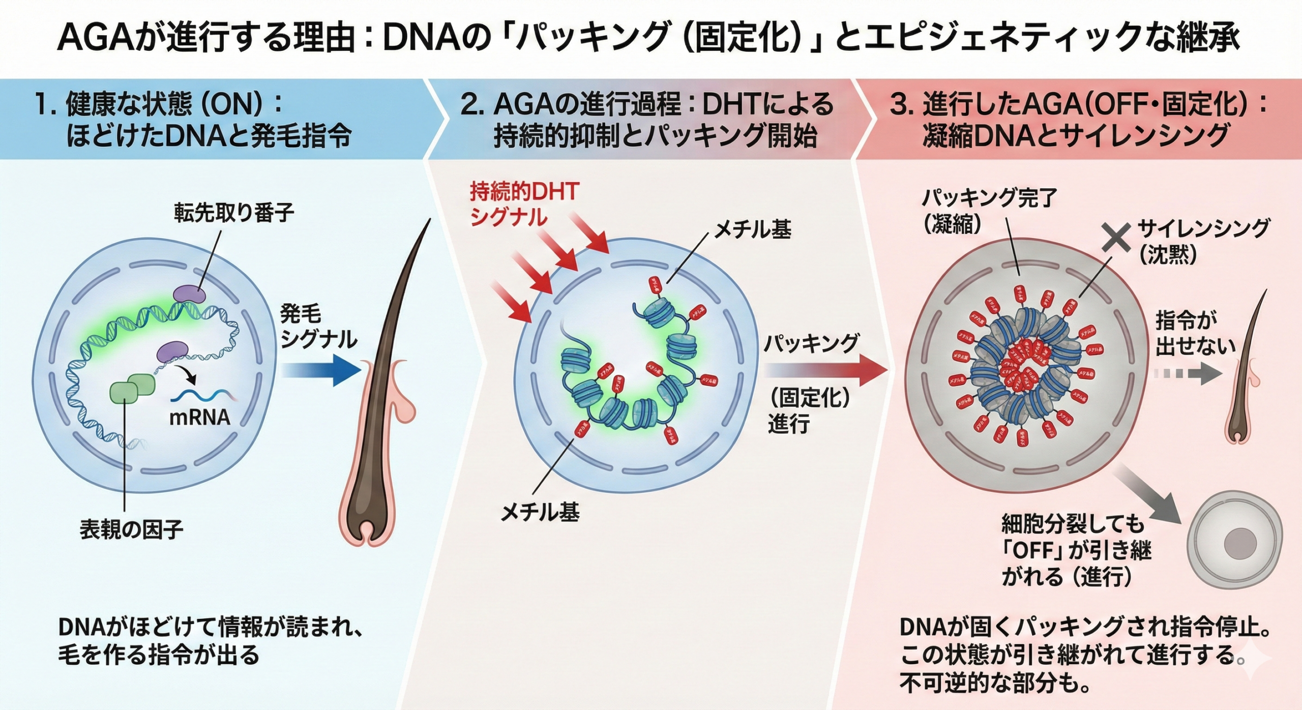 AGAが進行する理由:DNAのパッキング(固定化)とエピジェネティックな継承
