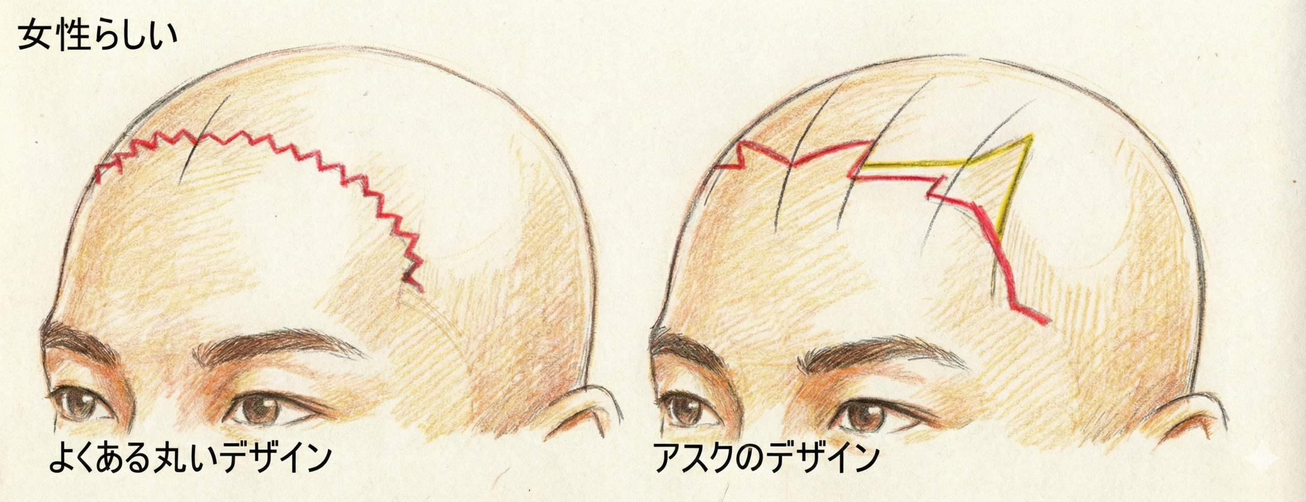 アスクと他院の違い 女性らしいデザイン